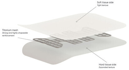 NeoGen Non-resorbable Membranes