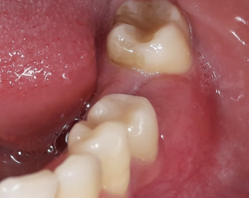 Fig. 2b