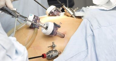 La chirurgia bariatrica potrebbe avere effetti negativi sulla salute orale