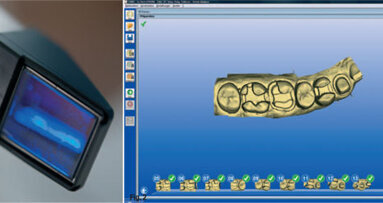 Simplified digital impression-taking