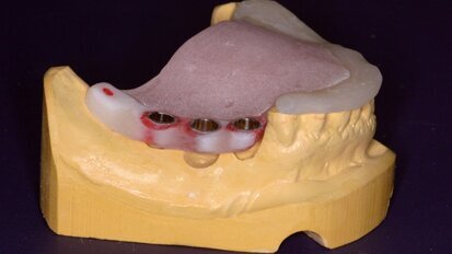 Image guided surgery