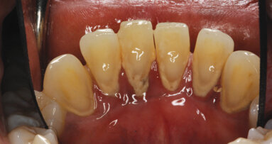 Systemic and dental factors affecting the prognosis of teeth