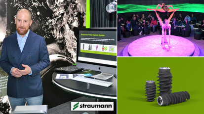 Straumann stellt auf der IDS neues Zahnimplantat BLX vor