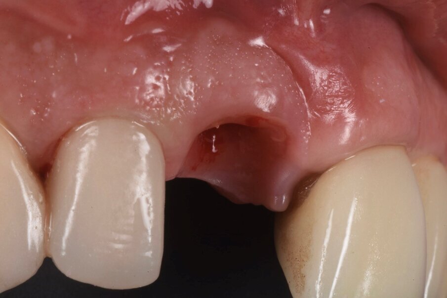 Fig. 16b