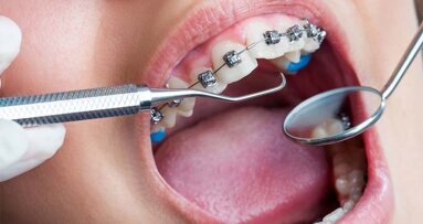 Online Event Emphasises On ‘Primary Healthcare & Practice Of Dentistry’