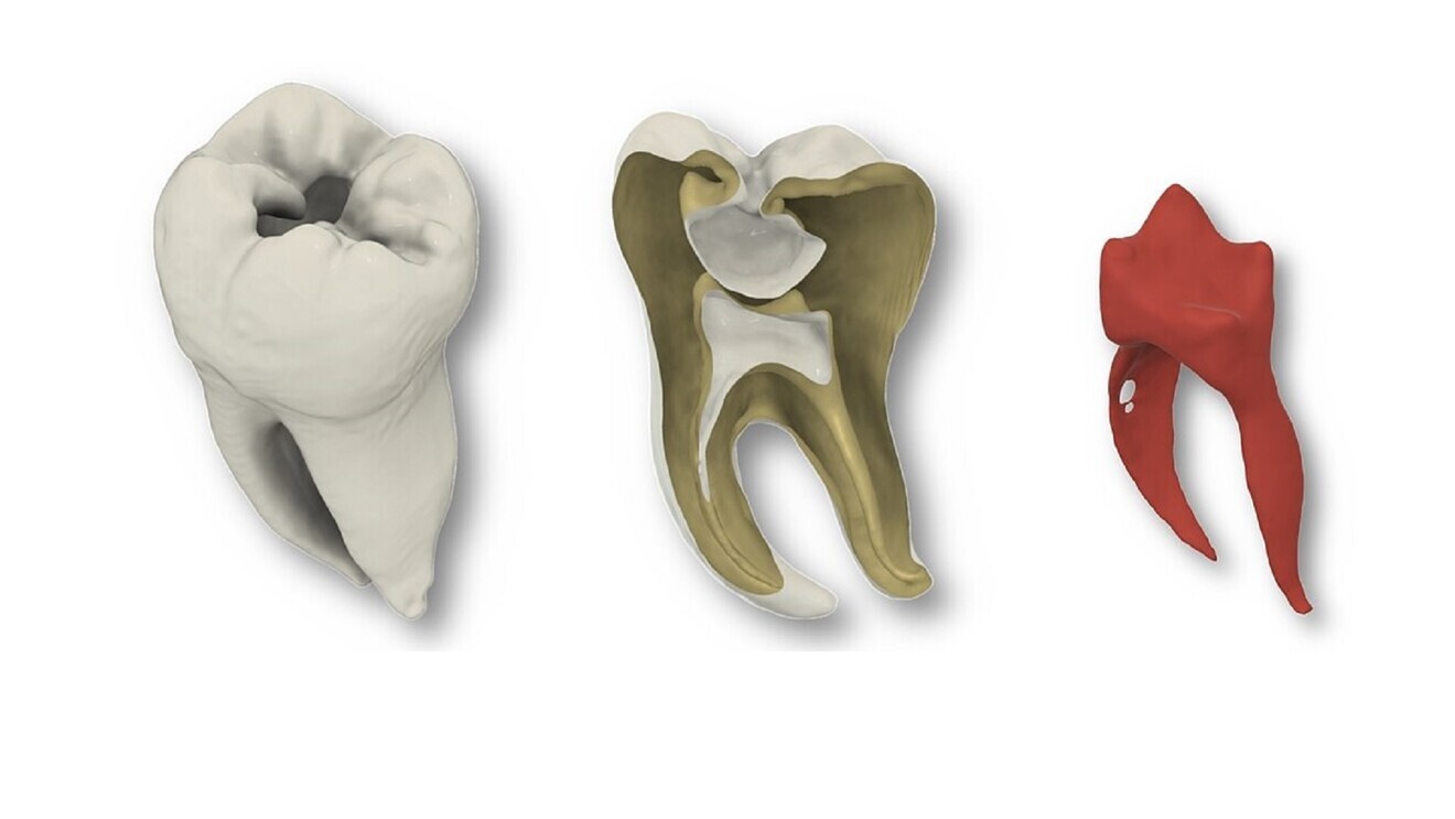 Reconstruction of a real tooth based on a micro-CT scan. From left: overview of the entire tooth, cross-section of the tooth; root canals and pulp. (Image: Christian Höhne/UKW)