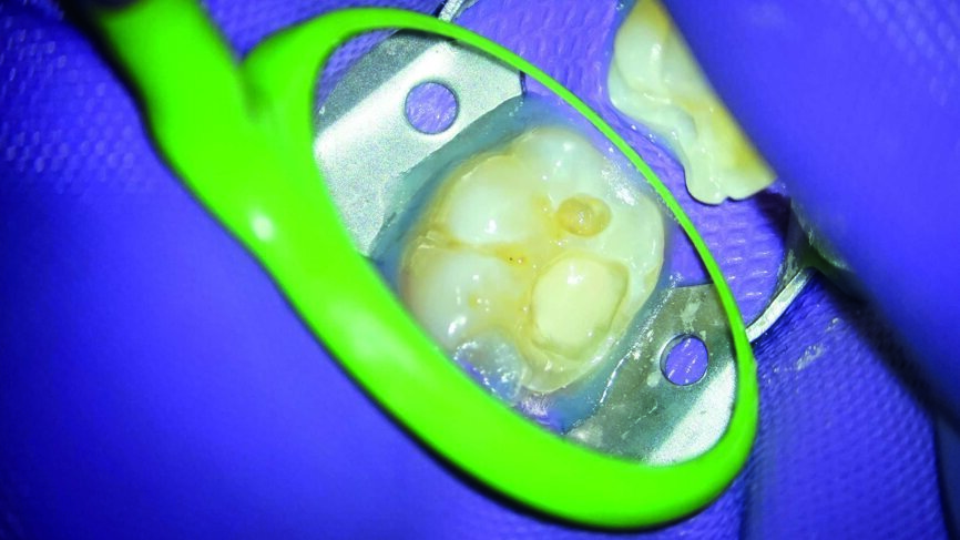 Fig. 7
