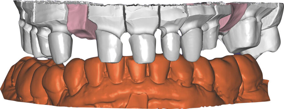 Fig. 55