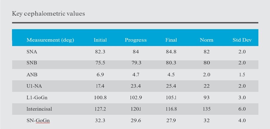 Cephalometric analysis summary (initial to final): The ANB angle improved by 2.4˚. The interincisal angle decreased from 127.2˚ to 116.8˚, as a result of a +8˚ change in upper incisor inclination and +4˚ increase in lower incisor inclination. Mandibular autorotation led to a -4.4˚ reduction in SN-GoGn.