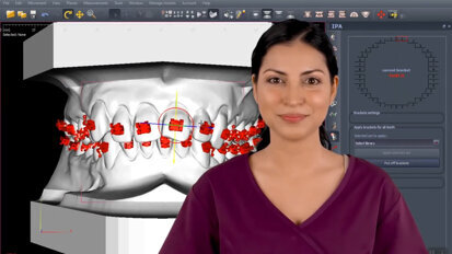 Polorto – DDP-Ortho – Explaining IPA – Individually Projected Appliances
