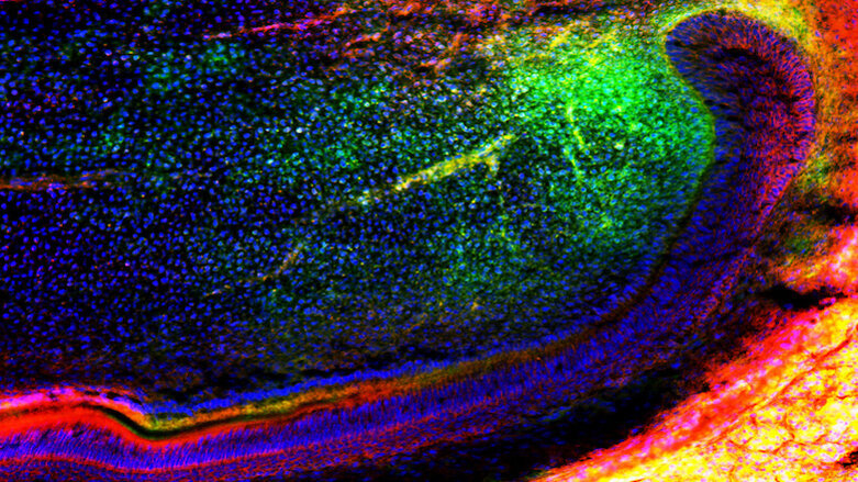 Scientists uncover gene that enhances tissue regeneration in tooth healing