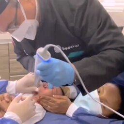 Labio y paladar fisurado Luna Video