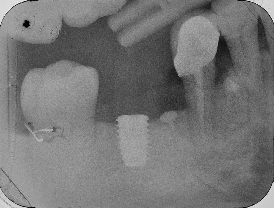 Fig. 18
