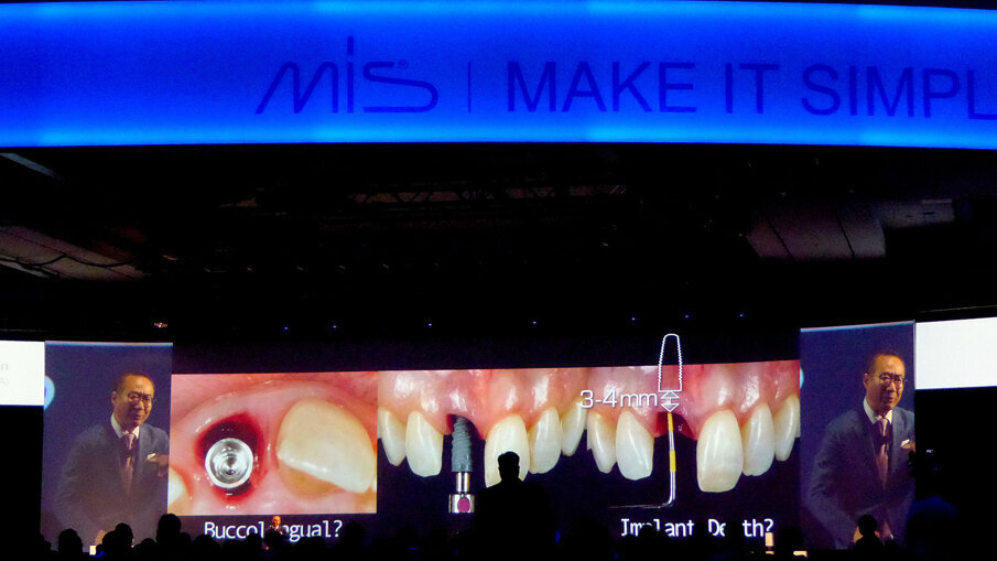 Professor Joseph Kan offered a fun but profound lecture on successes and failures in implant dentistry.