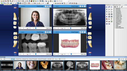 Henry Schein One launches Dentrix G7 in Canada