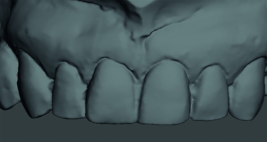 Fig. 10g