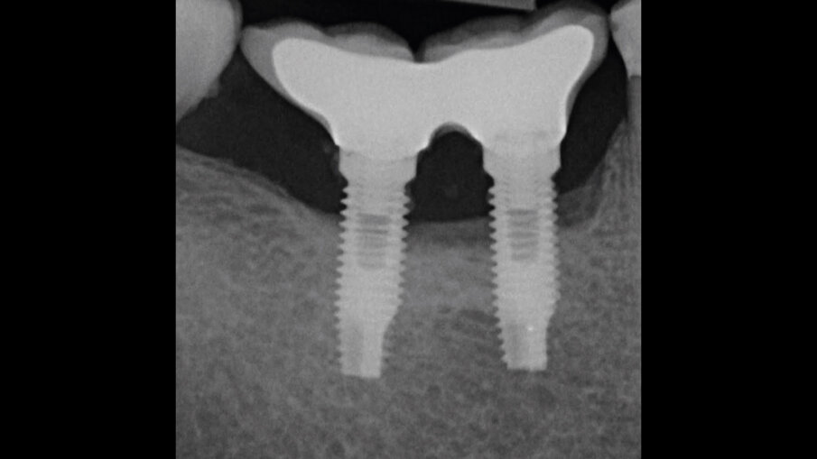 Fig. 1f