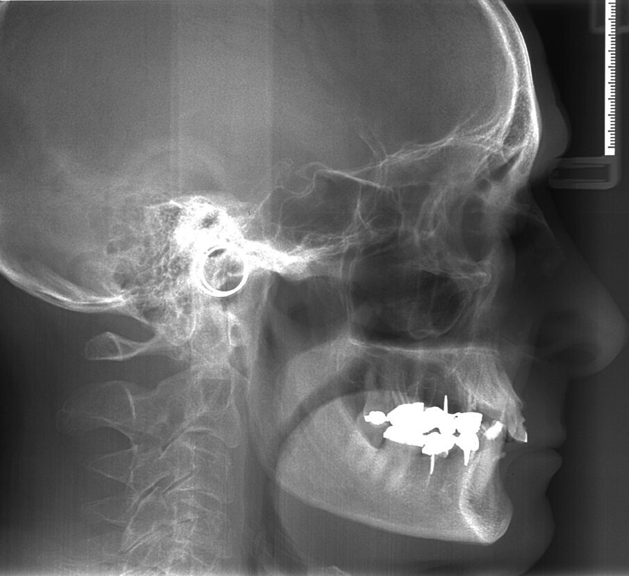 Fig. 9