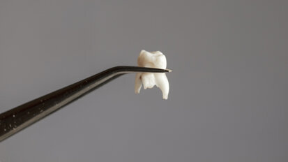 Machine-learning algorithms may help in predicting tooth loss