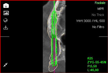 Fig. 25d