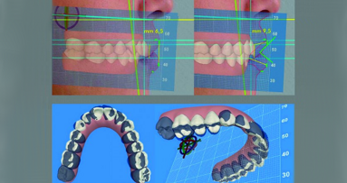 Analyse esthétique dento-faciale au moyen d’un logiciel tridimensionnel (3D) Synergie entre dentisterie esthétique et médecine esthétique