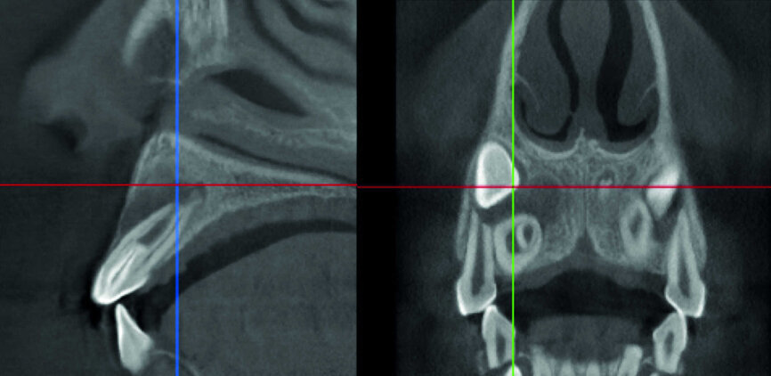 Figure 33