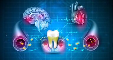 EFP publishes report on needed collaboration between dental professionals and general practitioners
