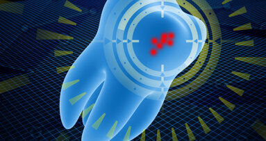 Short-wavelength-infrared imaging shows potential for detection of secondary carious lesions