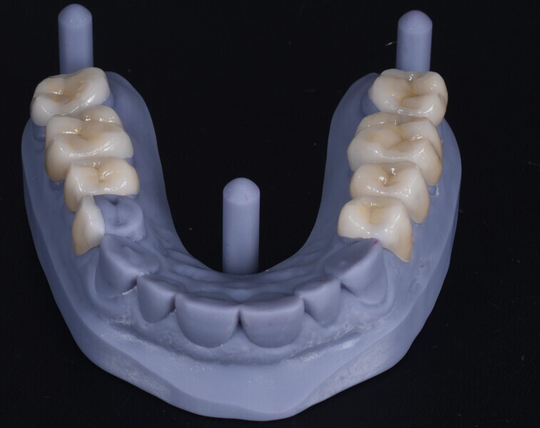 Fig. 5b.