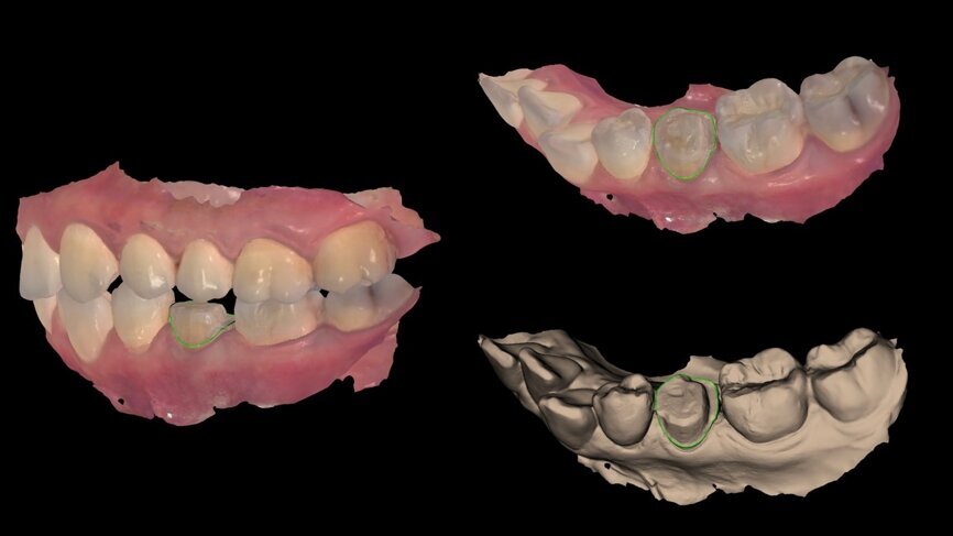 Fig. 9