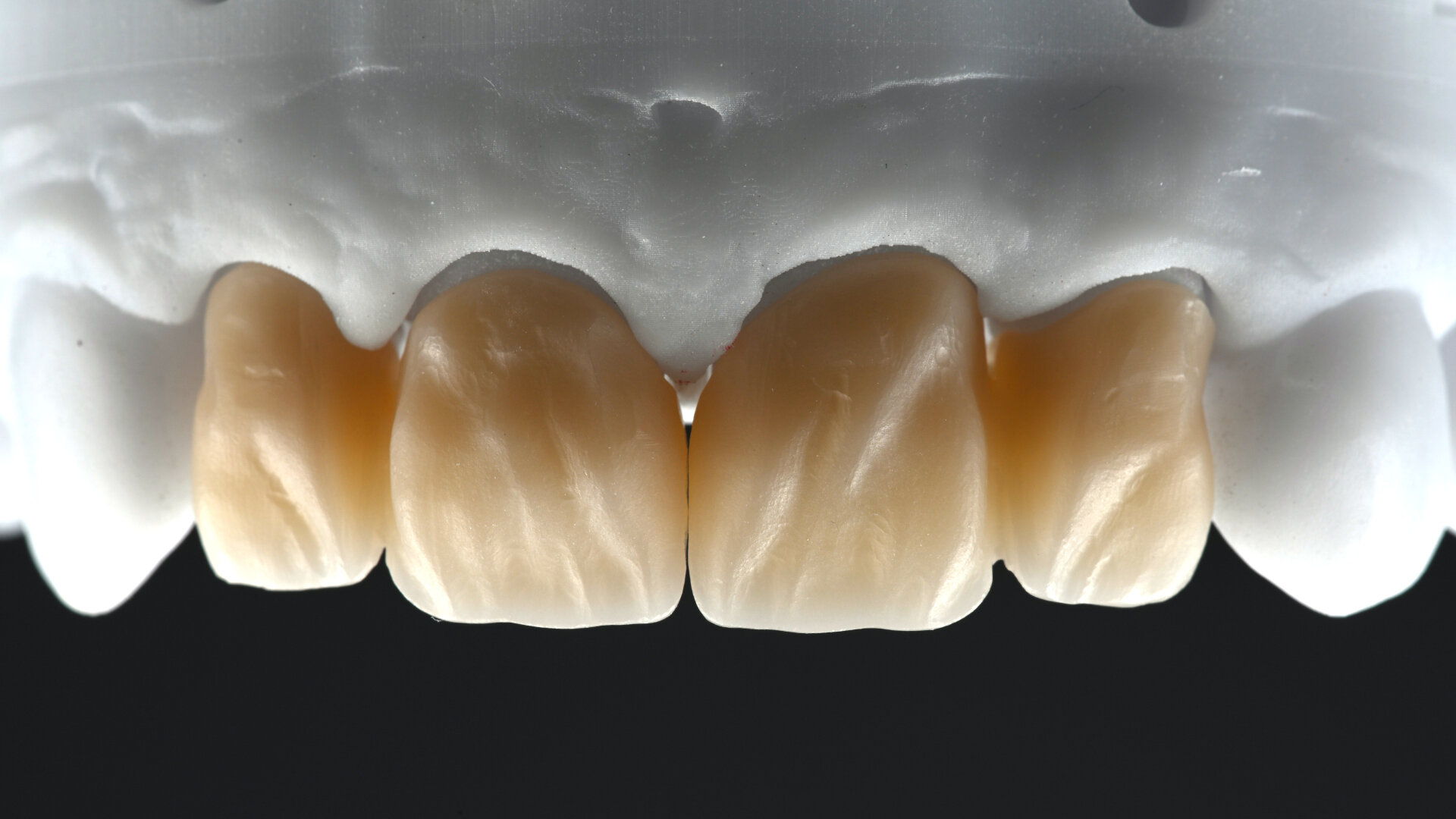 Une formule simple pour de merveilleux sourires