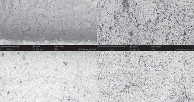 SEM surface analyses of 120 sterile-packed implants