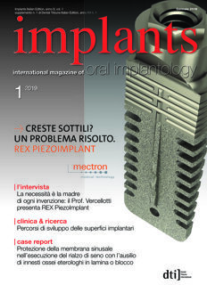 implants Italy No. 1, 2019