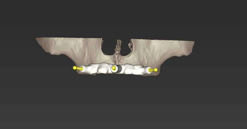 Fig. 11