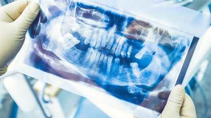 FDI: Neuer Behandlungspfad für teilbezahnte Patienten vorgelegt