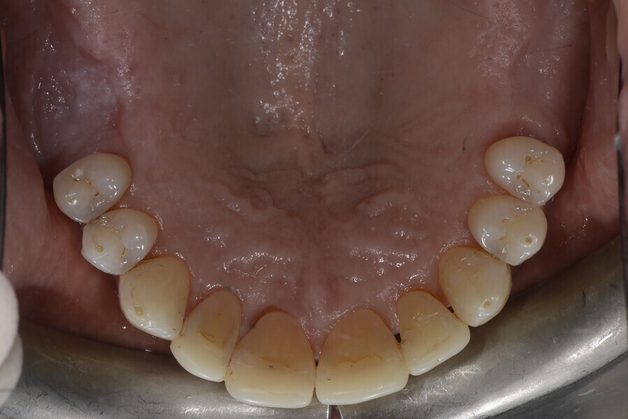 Fig. 23d