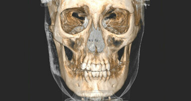 L’introduzione della tecnologia nello studio odontoiatrico: la cone-beam CT