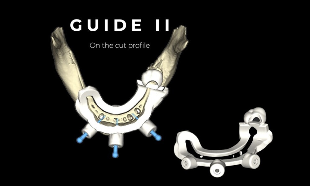 Fig. 23