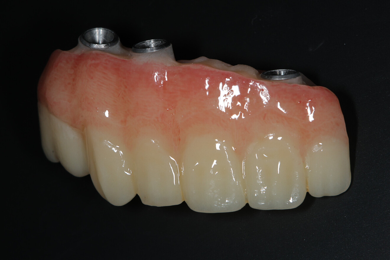Fig. 5c: After staining and glazing.