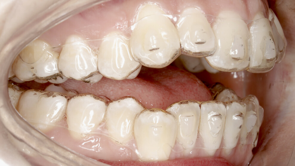 Fig. 4b