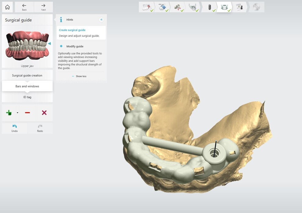 Fig. 5: Surgical guide design on 3Shape Implant Studio.