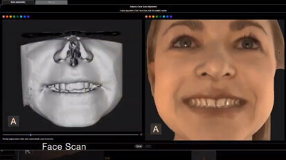CBCT, Vaše cesta k úspěchu – pokročilý extraorální zobrazovací systém