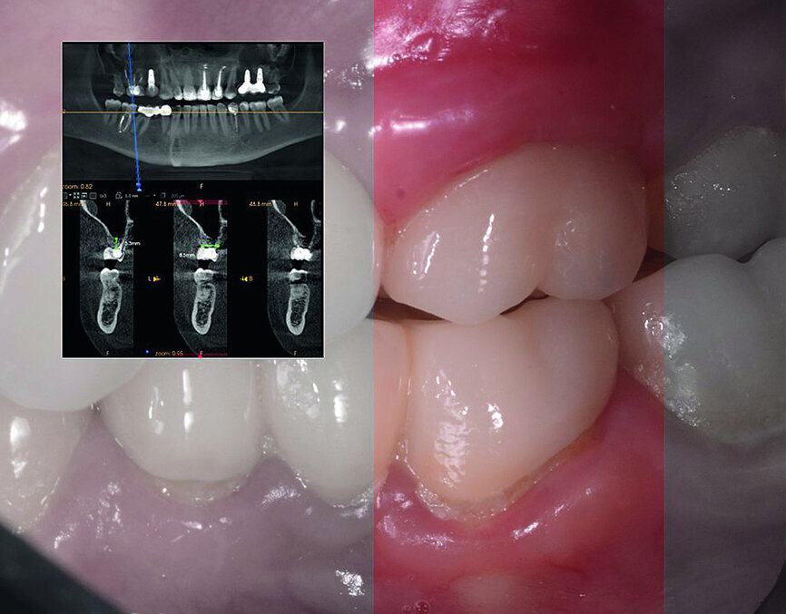 Fig. 1a