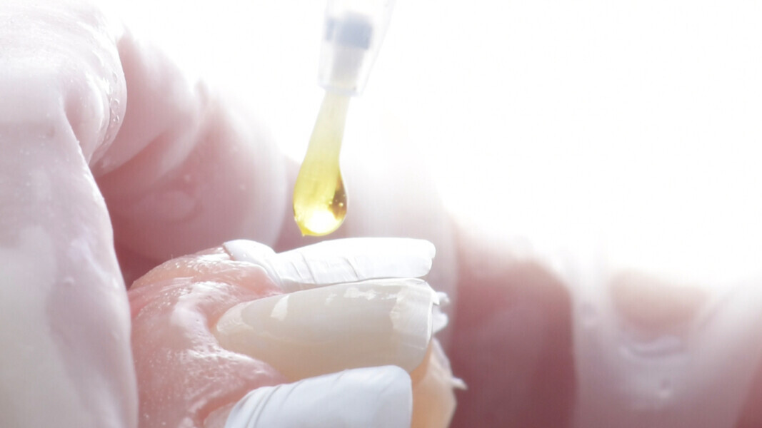Fig. 7: Application of CLEARFIL Universal Bond Quick to the prepared surface.