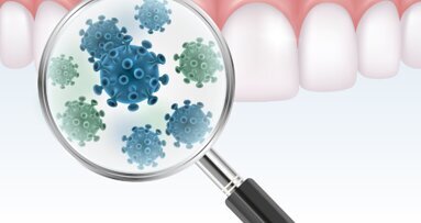 SARS-CoV-2 might enter lungs through gingivae, experts say