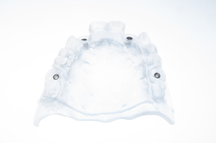 Fig. 19