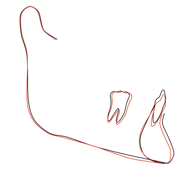 Fig. 37