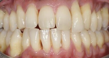 Practical periodontics in daily practice