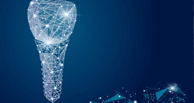 Implants individuels basés sur des procédures CAO/FAO