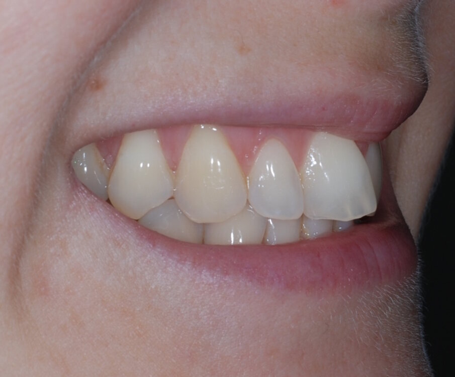 Fig. 2: Pre treatment right lateral
